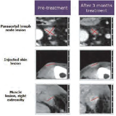 [MISSING IMAGE: tm215958d1-ph_pretreat4clr.jpg]
