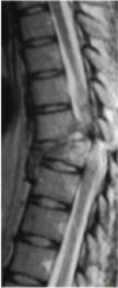 rewalkspinea01.jpg