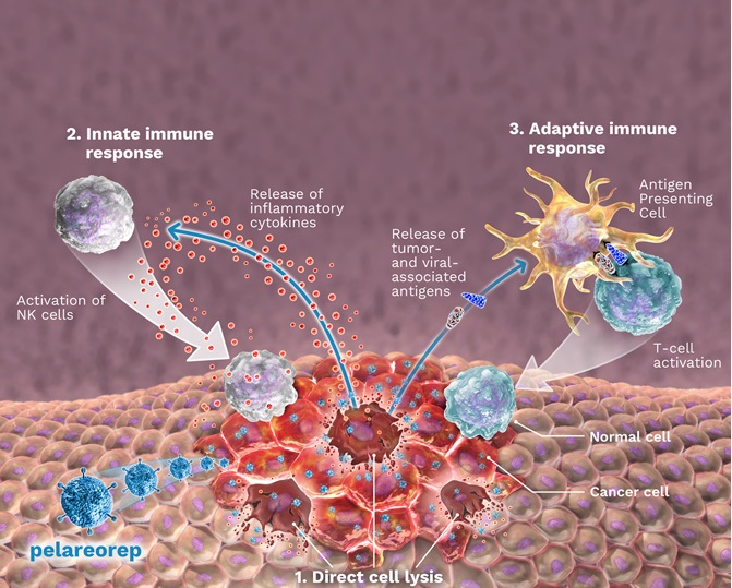 reolysinmoapanel4smalla02.jpg