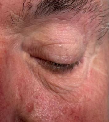 Redness Image.jpg