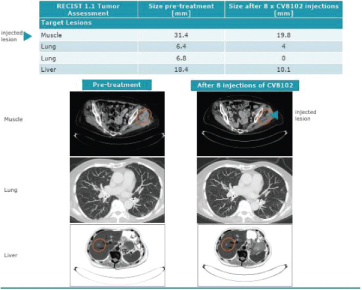 [MISSING IMAGE: tm215958d1-ph_combin4clr.jpg]