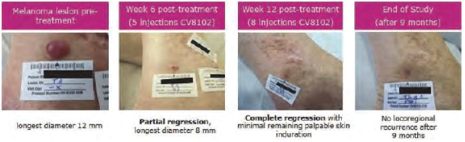 [MISSING IMAGE: tm215958d1-ph_single4clr.jpg]