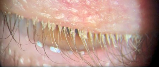 Eyelashes.jpg