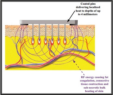 image provided by client