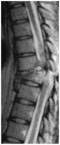 brokenspine20fa03.jpg