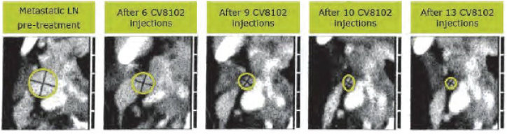 [MISSING IMAGE: tm215958d1-ph_hnscc4clr.jpg]