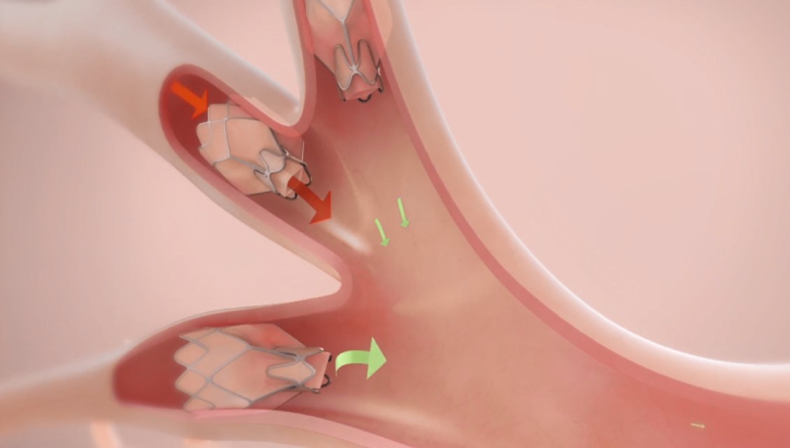 lung-20201231_g10.jpg