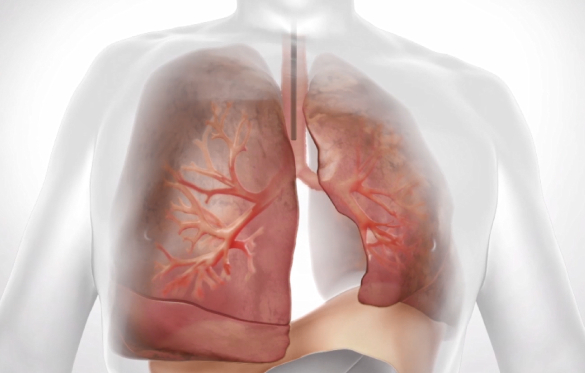 lung-20201231_g11.jpg