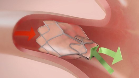 lung-20211231_g9.jpg