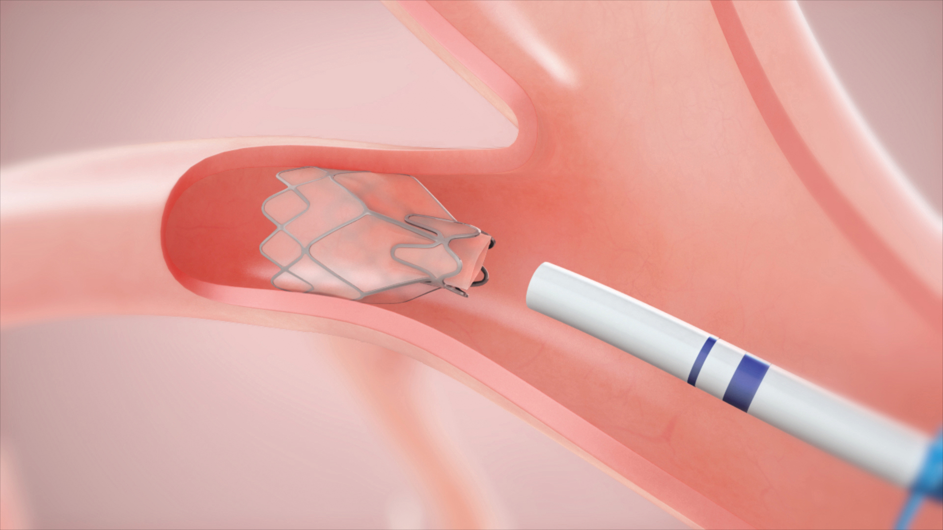 lung-20221231_g6.jpg